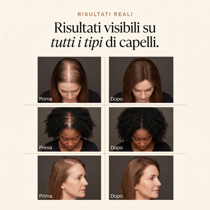 Siero crescita capelli Manami™